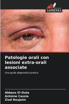 Patologie orali con lesioni extra-orali associate - El-Outa, Abbass;Cassia, Antoine;Noujeim, Ziad