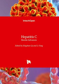 Hepatitis C - Recent Advances