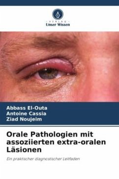 Orale Pathologien mit assoziierten extra-oralen Läsionen - El-Outa, Abbass;Cassia, Antoine;Noujeim, Ziad