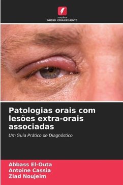 Patologias orais com lesões extra-orais associadas - El-Outa, Abbass;Cassia, Antoine;Noujeim, Ziad