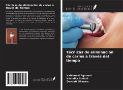 Técnicas de eliminación de caries a través del tiempo - Agarwal, Vaishnavi; Sodani, Vasudha; Sharma, Devdatt