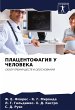 PLACENTOFAGIYa U ChELOVEKA - Bild 1