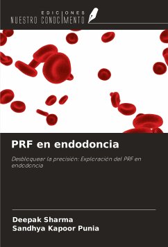 PRF en endodoncia - Sharma, Deepak; Punia, Sandhya Kapoor