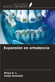 Expansión en ortodoncia