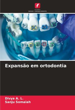 Expansão em ortodontia - A. L., Divya;Somaiah, Sanju