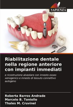 Riabilitazione dentale nella regione anteriore con impianti immediati - Andrade, Roberta Barros;Toniollo, Marcelo B.;Cruvinel, Thales M.