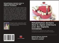Réhabilitation dentaire dans la région antérieure avec des implants immédiats - Andrade, Roberta Barros;Toniollo, Marcelo B.;Cruvinel, Thales M.