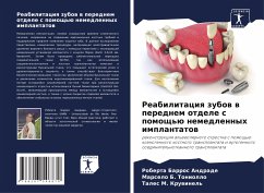 Reabilitaciq zubow w perednem otdele s pomosch'ü nemedlennyh implantatow - Andrade, Roberta Barros;Toniollo, Marselo B.;Kruwinel', Tales M.