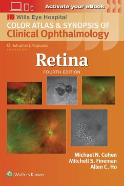 Retina - Fineman, Mitchell S.