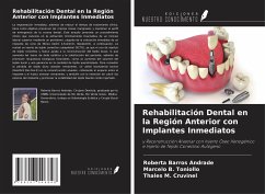 Rehabilitación Dental en la Región Anterior con Implantes Inmediatos - Andrade, Roberta Barros; Toniollo, Marcelo B.; Cruvinel, Thales M.