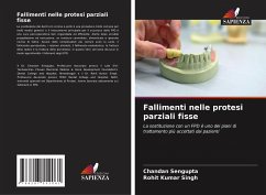 Fallimenti nelle protesi parziali fisse - Sengupta, Chandan;Singh, Rohit Kumar