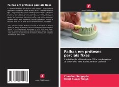 Falhas em próteses parciais fixas - Sengupta, Chandan;Singh, Rohit Kumar