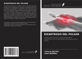 RIZARTROSIS DEL PULGAR