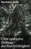 Über operative Heilung der Kurzsichtigkeit (eBook, ePUB)