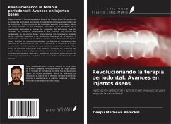 Revolucionando la terapia periodontal: Avances en injertos óseos - Mathews Panickal, Deepu
