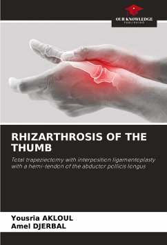 RHIZARTHROSIS OF THE THUMB - AKLOUL, Yousria;DJERBAL, Amel