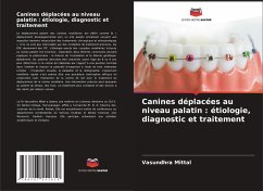 Canines déplacées au niveau palatin : étiologie, diagnostic et traitement - Mittal, Vasundhra