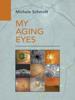 My Aging Eyes (eBook, ePUB) - Schmidt, Michele