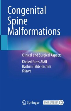 Cover Congenital Spine Malformations (eBook, PDF)