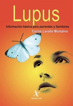 Lupus. Información básica para pacientes familiares (eBook, PDF) - Lavalle Montalvo, Carlos