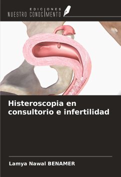 Cover Histeroscopia en consultorio e infertilidad