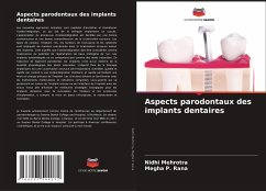 Aspects parodontaux des implants dentaires - Mehrotra, Nidhi;P. Rana, Megha