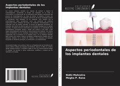 Aspectos periodontales de los implantes dentales - Mehrotra, Nidhi; P. Rana, Megha