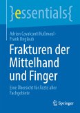 Frakturen der Mittelhand und Finger (eBook, PDF)