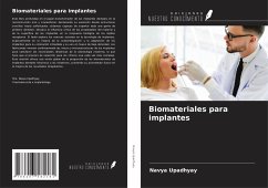 Biomateriales para implantes - Upadhyay, Navya