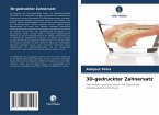 3D-gedruckter Zahnersatz