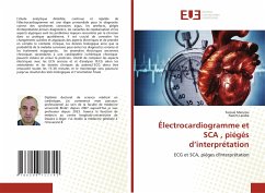 Électrocardiogramme et SCA , piégés d¿interprétation - Menzou, Farouk;Laraba, Nazim