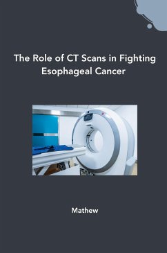 The Role of CT Scans in Fighting Esophageal Cancer - Mathew