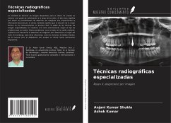 Técnicas radiográficas especializadas - Shukla, Anjani Kumar; Kumar, Ashok