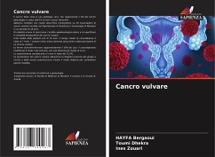 Cancro vulvare - Bergaoui, HAYFA;Dhekra, Toumi;Zouari, Ines