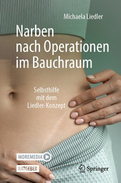 Narben nach Operationen im Bauchraum (eBook, PDF) - Liedler, Michaela