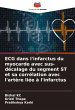 ECG dans l'infarctus du myocarde avec... - Bild 1