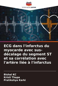 ECG dans l'infarctus du myocarde avec sus-décalage du segment ST et sa corrélation avec l'artère liée à l'infarctus - KC, Bishal;Thapa, Kristi;Karki, Pratikshya