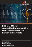 ECG nel MI con sopraslivellamento ST e sua correlazione con l'arteria infartuata