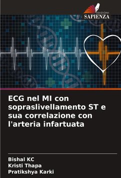 ECG nel MI con sopraslivellamento ST e sua correlazione con l'arteria infartuata - KC, Bishal;Thapa, Kristi;Karki, Pratikshya