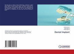 Dental Implant - Kumari, Amrita;Sharma, Alok;Sharma, Swati