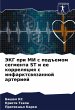 JeKG pri MI s pod#emom segmenta ST i ee... - Bild 1