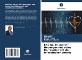 EKG bei MI mit ST-Hebungen und seine Korrelation mit der infarktnahen Arterie