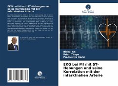 EKG bei MI mit ST-Hebungen und seine Korrelation mit der infarktnahen Arterie - KC, Bishal;Thapa, Kristi;Karki, Pratikshya