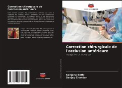 Correction chirurgicale de l'occlusion antérieure - Sethi, Sanjana;Chandan, Sanjay
