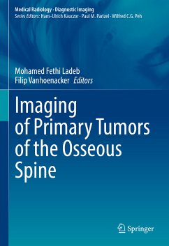 Imaging of Primary Tumors of the Osseous Spine (eBook, PDF)