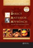The Direct Anterior Approach to Hip Reconstruction (eBook, PDF)