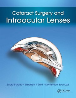 Cover Cataract Surgery and Intraocular Lenses (eBook, ePUB)