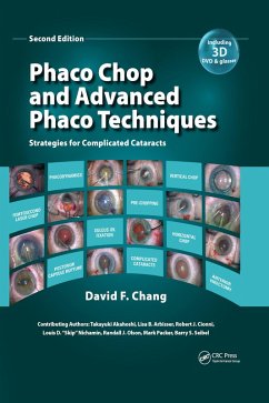 Phaco Chop and Advanced Phaco Techniques (eBook, ePUB) - Chang, David F.