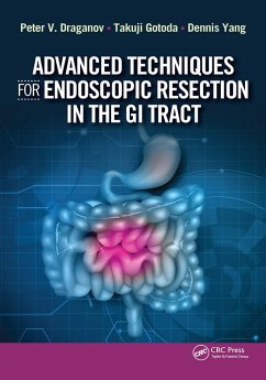 Advanced Techniques for Endoscopic Resection in the GI Tract (eBook, ePUB) - Draganov, Peter; Gotoda, Takuji; Yang, Dennis