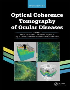 Cover Optical Coherence Tomography of Ocular Diseases (eBook, ePUB)